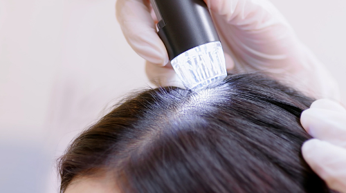 woman having scalp assessed for scalp health