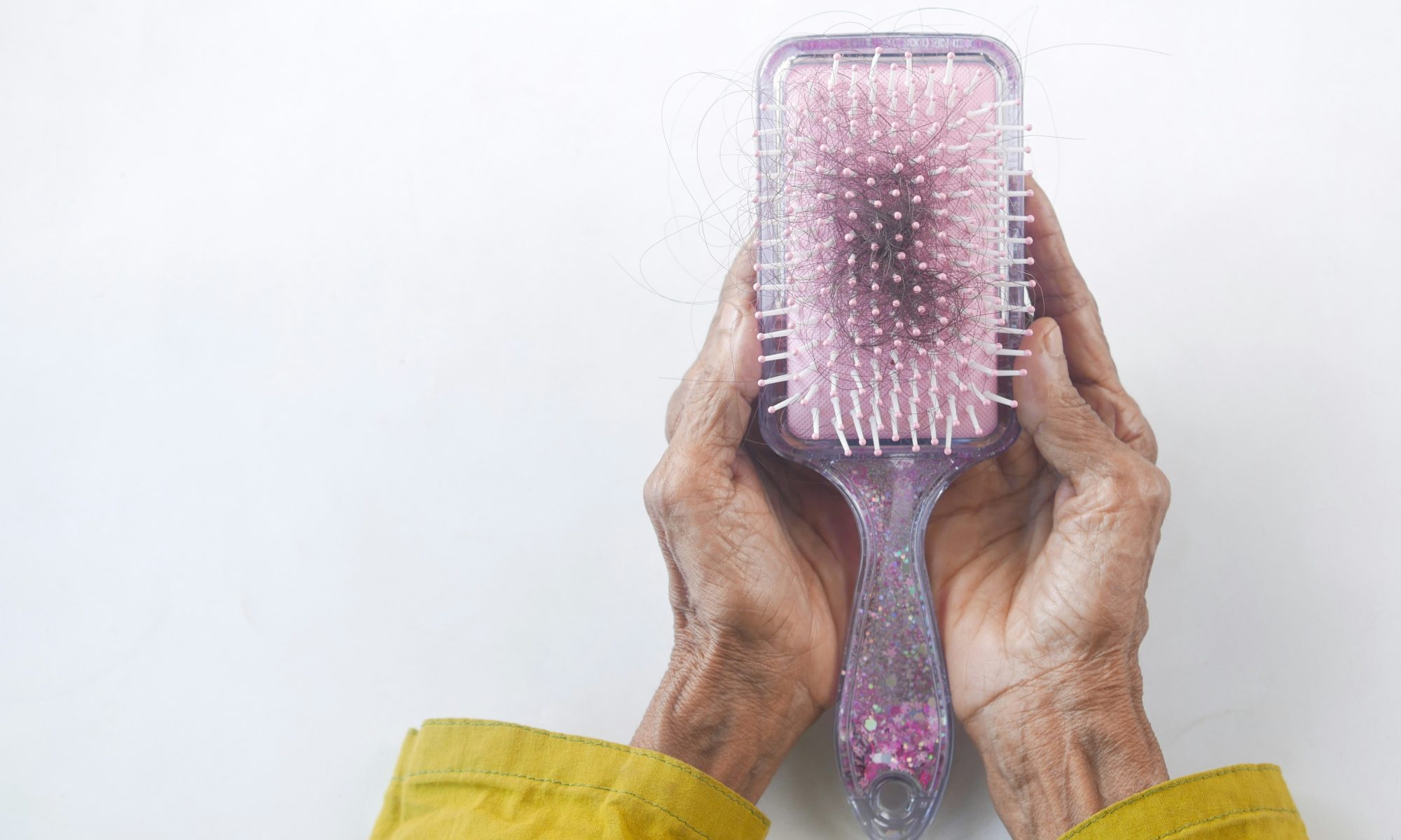 hair loss awareness month brush with hair in it